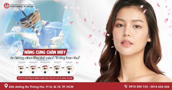 Khoảng thời gian cần kiêng bún mắm và thực phẩm khác sau nâng mũi, nhấn mạnh 4-6 tuần đầu tiên và khả năng kiêng lâu hơn tùy cơ địa